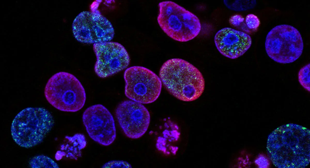 4dPharmacelebratespromisingnewresearchonLiveBiotherapeuticincancerDDDD-Hero_2ec9de3d210cc4e7b0a159cd6d22f1af_2000