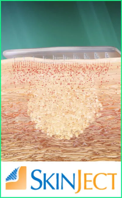 Medicus Pharma SkinJect Skin Cancer Patch